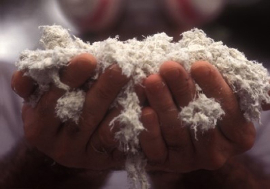 Lung most cancers cell type and asbestos publicity mesothelioma presentation